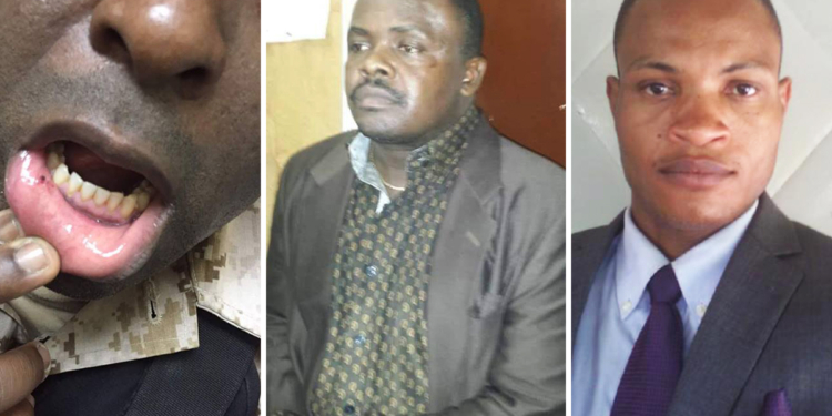 Quand le directeur départemental de l’Ouest de la PNH brutalise la justice  