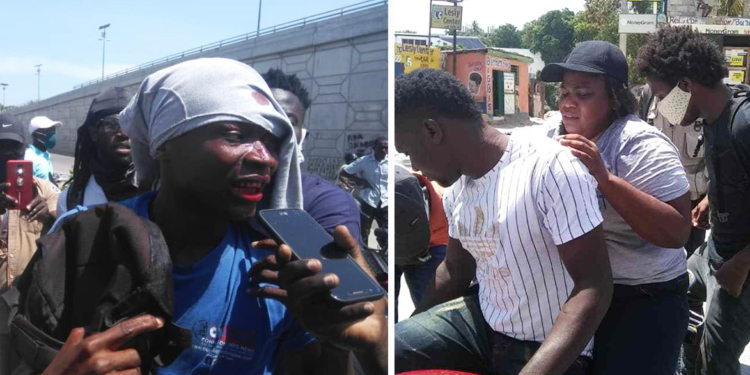 2 journalistes blessés, l’AHML dénonce la brutalité brutalité policière du 7 juin