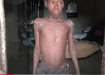 Appel aux dons pour sauver la vie de Tawensky Charles!