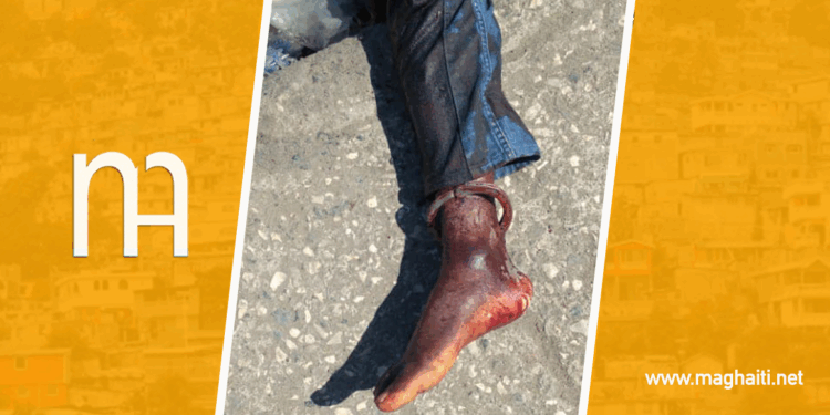 Arnel Joseph tué à L’Estère par la police 24 heures après son évasion