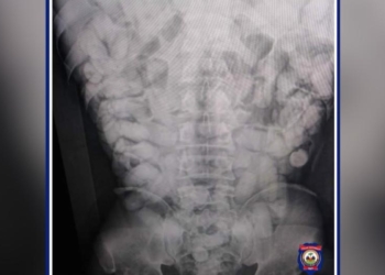 Un homme transportant 1,35 Kg de cocaïne au niveau de son abdomen arrêté par la PNH