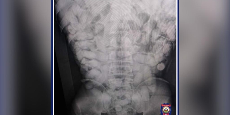 Un homme transportant 1,35 Kg de cocaïne au niveau de son abdomen arrêté par la PNH