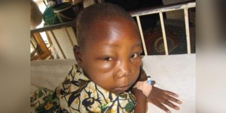 Yon maladi ki rele Glomerilonefrit egi kòmanse atake anpil timoun an Ayiti